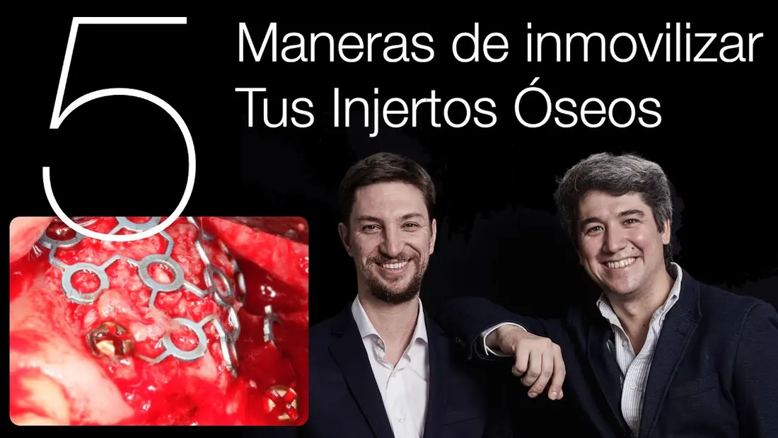 Fotograma de apertura del vídeo del canal DL Cirugía Oral